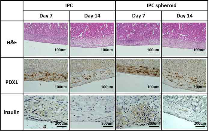 신장 피막에 인슐린 생성세포 및 구상체 이식후 PDX1 유전자 발현 및 인슐린 발현 세포 조직학적 분석