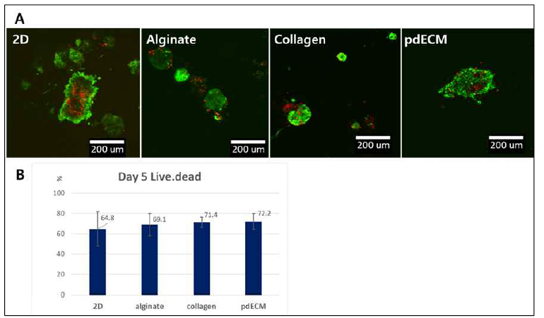 Human으로부터 분리한 췌도 세포를 이용하여 2D, alginate, collagen, pdECM 환경에서 5일간 배양한 후 (A) Live/dead assay 염색 및 (B) 생존율 분석 결과