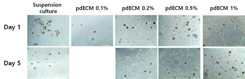 pdECM 농도에 따른 IPC spheroid의 형상 관찰 결과