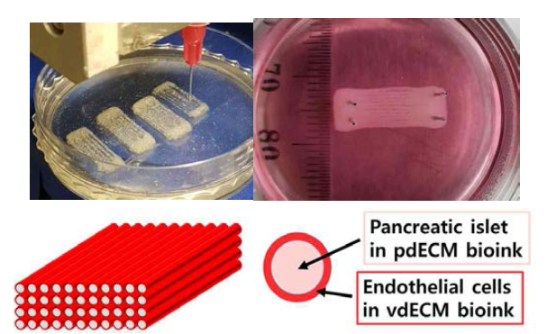 동축 노즐을 활용한 췌도 세포 및 내피 세포의 프린팅 및 해당 3차원 췌장 구조체 모식도