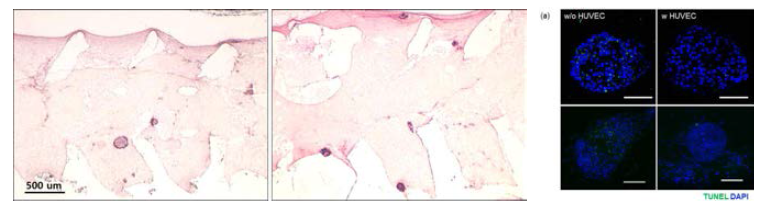 혈관화 세포주가 췌도 세포에 미치는 영향 확인. 인간 탯줄 정맥 내피 세포(HUVEC)를 함께 봉입하지 않은 실험군에서 더 많은 세포 사멸 확인