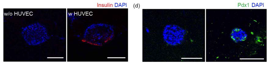 혈관 세포와의 공배양에 따른 islet의 인슐린 및 PDX1 발현 분석 결과