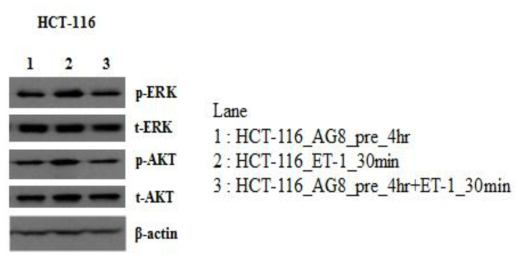 ET-1과 AG8 항체 처리에 따른 HCT-116 암세포주의 ERK, AKT의 phosphorylation 실험 결과