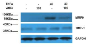 TNF-α와 TIMP-1의 MMP-9의 발현
