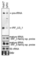 Huh7 세포주와 primary 인간 간세포에서 tRF_U3_1과 상응하는 mature tRNA의 발현차이를 northern blotting으로 분석한 결과