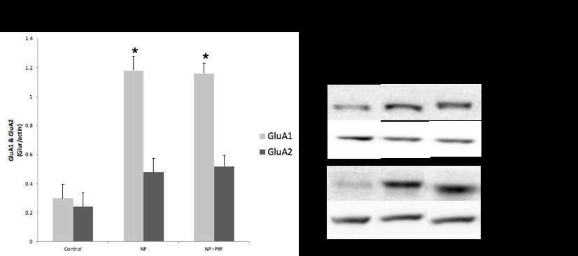 디스크 탈출 만성통증의 쥐의 AMPA receptor의 Western blot의 결과