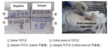 자극성시험 과정 및 방법