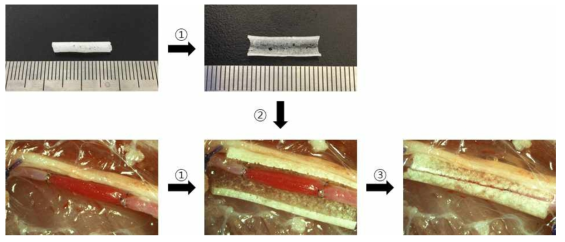 Vein to artery 수술부위에 튜브 타입 다공성 고분자를 장착하는 모식도
