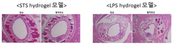 hydrogel을 이용한 협착유도 확립