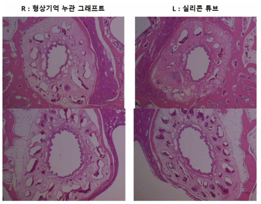 형상기억 누관 그래프트와 실리콘 튜브를 삽입한 코눈물관 조직