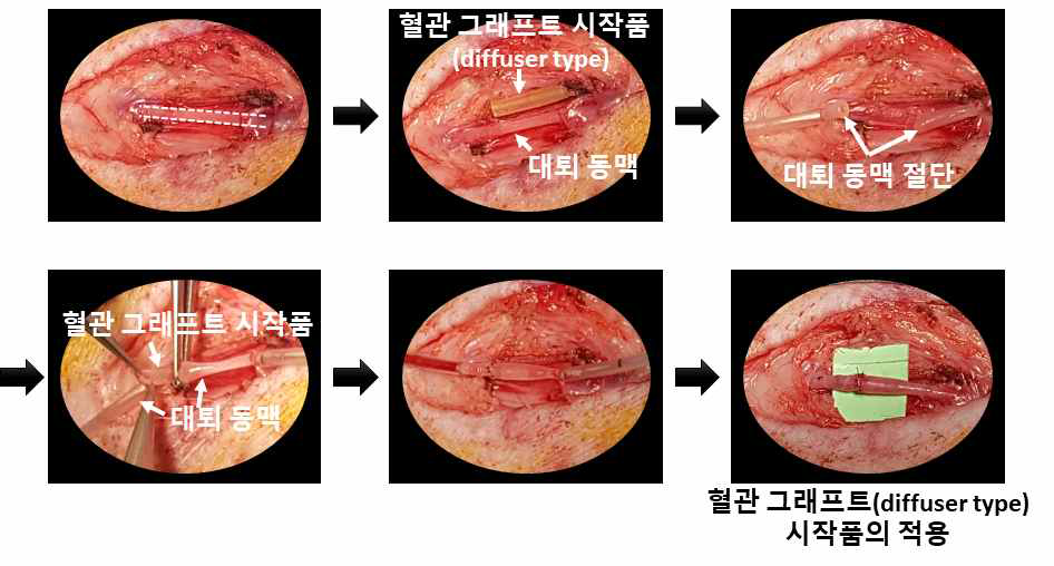 고분자 기반 혈관 그래프트(diffuser type) 시작품의 적용