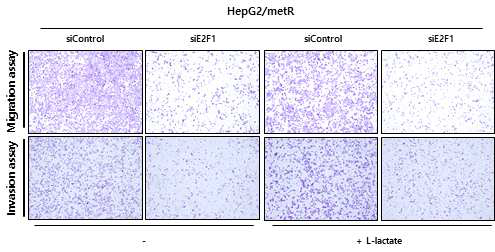 E2F1 유전자 발현 억제를 통한 세포 이동성 검증