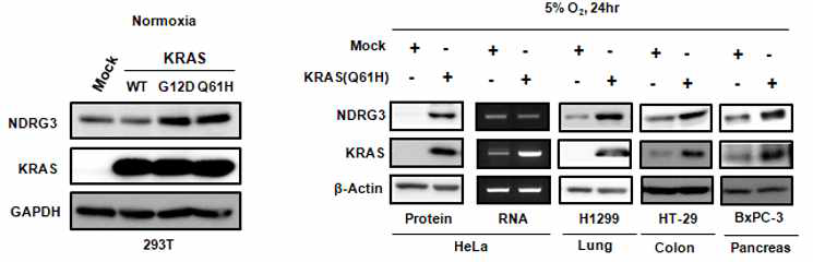 KRAS 돌연변이 과발현에 의한 NDRG3의 발현 수준 증가 확인