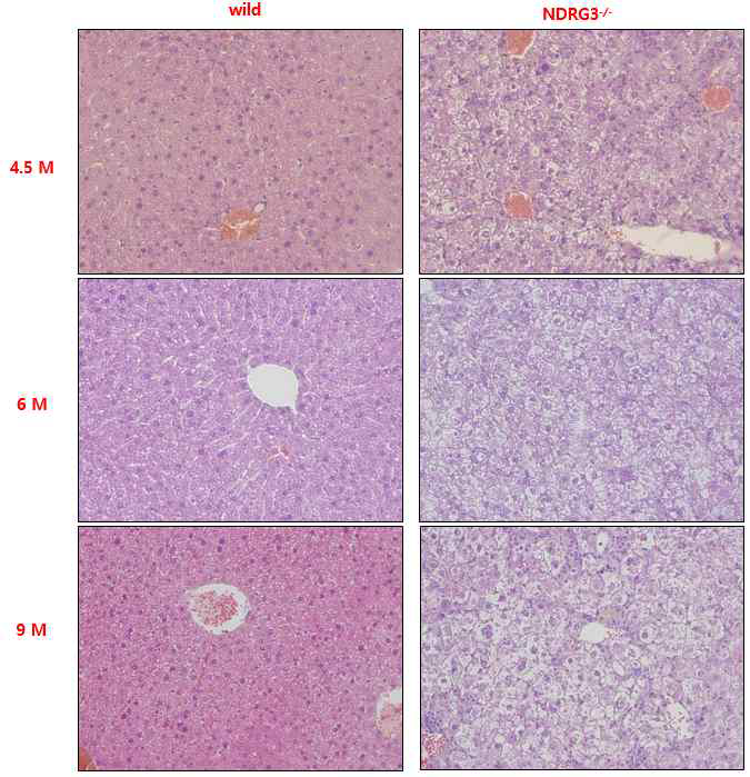 NDRG3 KO 마우스의 간 조직염색