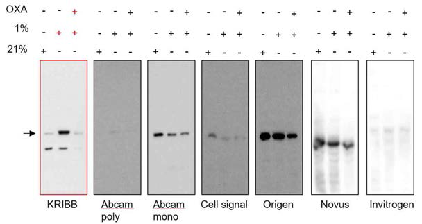 Cell-based 약물 스크리닝을 위한 NDRG3 항체 조사