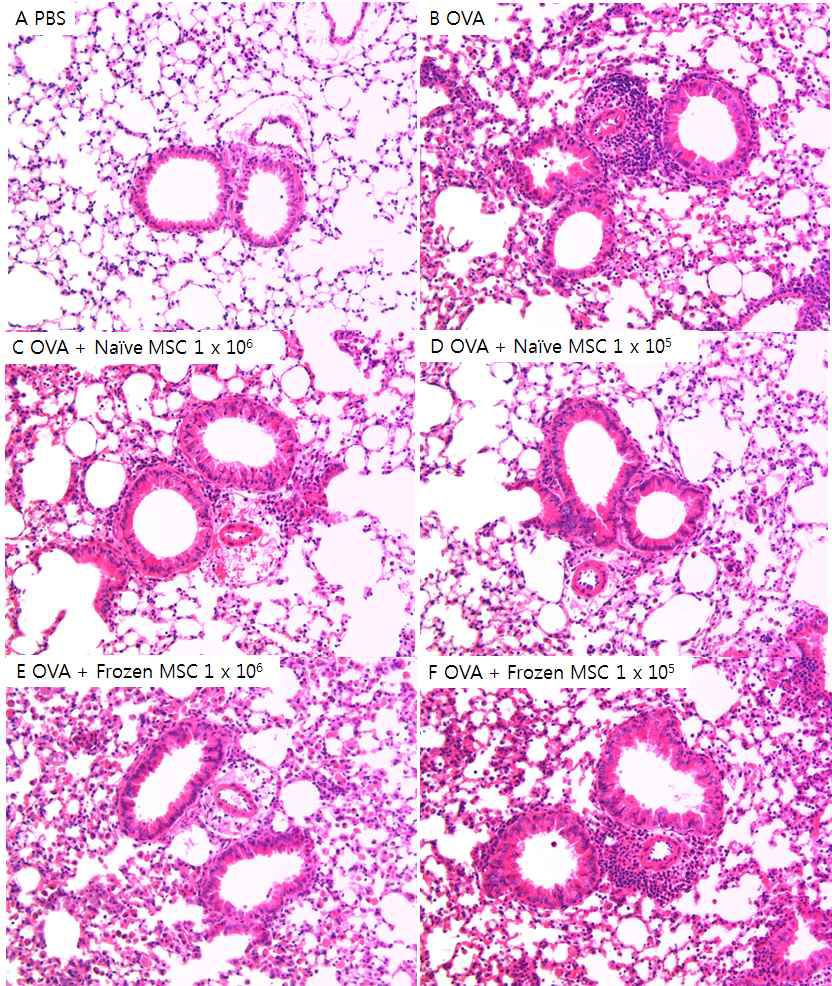 OVA 천식모델에서 MSC 종류 및 용량에 따른 조직 염증소견의 차이