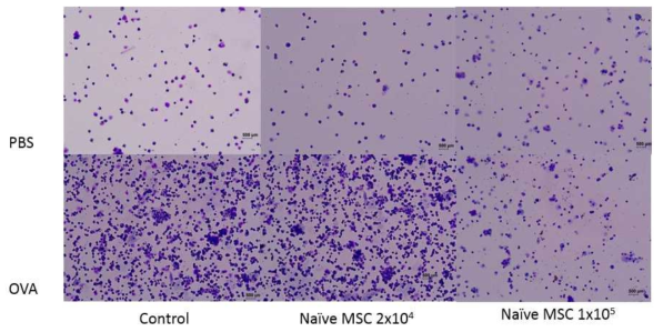 투여 용량에 따른 MSC의 항천식 효과 비교(BAL cell cytospin) (배율: x20. OVA 그룹은 PBS 그룹에 비하여 2배 희석)