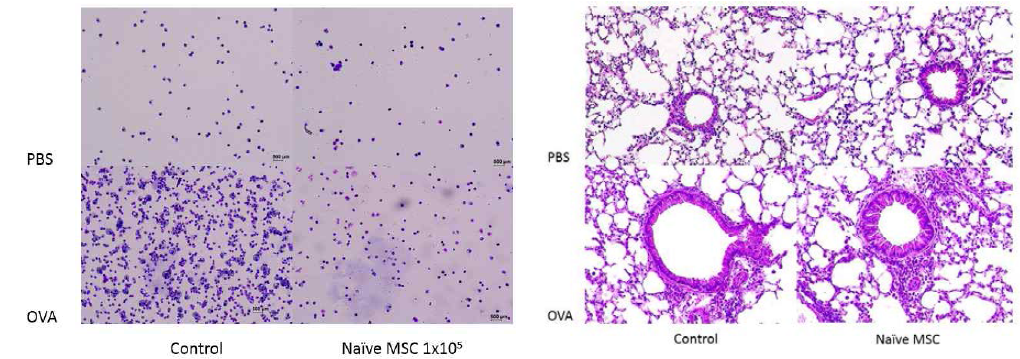 기도로 투여한 naive MSC의 항천식 효과. (A) BAL fluid cytospin (배율: x20. OVA 그룹은 PBS 그룹에 비하여 2배 희석)과 (B) 폐조직(H&E stain x 40)