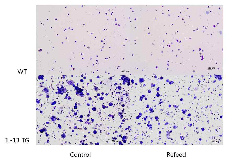 Refeed MSC가 IL-13TG mouse의 기도염증에 미치는 영향