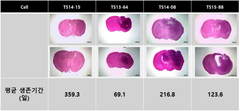 H&E 염색을 통한 악성 뇌암 PDX 마우스 종양 확인