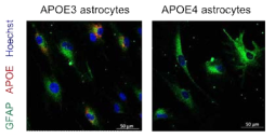 APOE3, APOE4 성상교세포의 제작