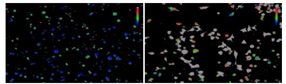 TRPC3 이온채널을 발현한 HEK293T 세포주에 SPC 1uM 처리 전 (좌) 및 처리 후(우)의 모습