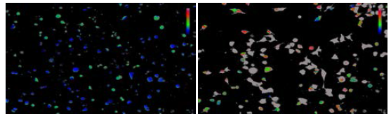pcDNA(Control)를 발현한 HEK293T 세포주에 SPC 1uM 처리 전 (좌) 및 처리 후(우)의 모습