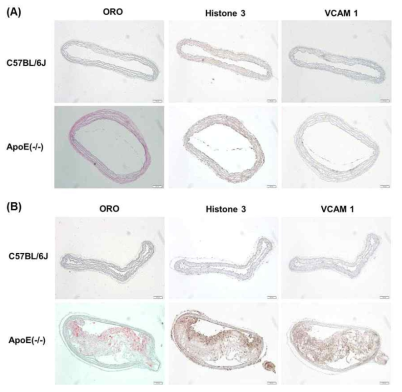 4주 동안 (동맥경화 조기진단용), 16주 동안 (동맥경화 고위험군 진단용) 동맥경화증을 유발시킬 수 있는 식이를 섭취한 ApoE(-/-) 마우스의 심장 동맥 조직을 지방조직, NETs, VCAM-1을 염색한 image