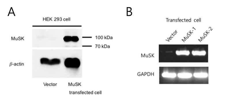 MuSK 형질주입을 시행한 HEK293세포에서 (A) Western bolt을 이용한 MuSK 단백 및 (B) RT-PCR을 이용한 MuSK mRNA 발현 확인. MuSK cDNA를 삽입하지 않은 Vector를 형질주입하였을 때에는 MuSK단백 및 mRNA가 검출되지 않음