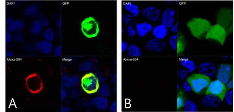 (A) 형광염색을 통하여 세포막 에서의 MuSK 단백 발현(녹색형광) 및 항-MuSK 항체의 binding(붉은형광)을 확인함. (B) Control vector (GFP only)에서는 녹색형광이 세포질 내에서만 관찰되며 항-MuSK 항체의 binding이 이루어지지 않음을 확인함