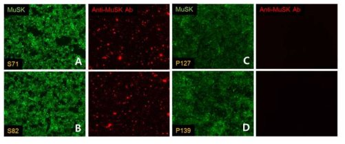 항-MuSK 항체 세포기반분석법 결과 예시. (A,B) 항-MuSK 항체 양성 (C,D) 항-MuSK 항체 음성