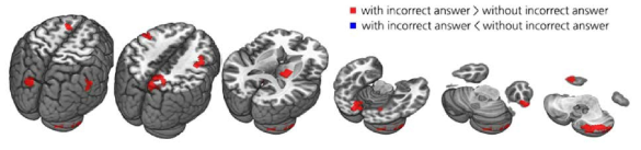 2-back 과제에서 한 번이라도 틀린 그룹이 그렇지 않은 그룹에 비해 더 활성화 되는 부위(빨간색 영역)
