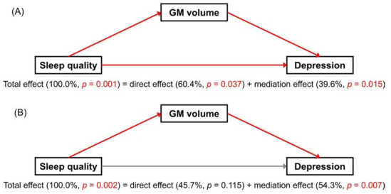 (A) left postcentral gyrus, (B) left superior temporal gyrus의 회백질 부피 감소는 수면 질 저하가 우울증 정도 증가에 미치는 영향을 상당 부분 매개함