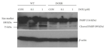 Doxorubicin 내성세포(DOXR)에 Doxorubicin 0.1, 1 μM 48시간 처리 후, PARP, Cleaved PARP 단백질 발현, β-actin = Endogenous loading control