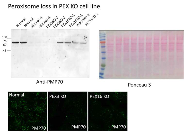 CRISPR-Cas9 기법을 이용하여 제작한 PEX3-KO, PEX16-KO HEK293 셀라인 검증결과