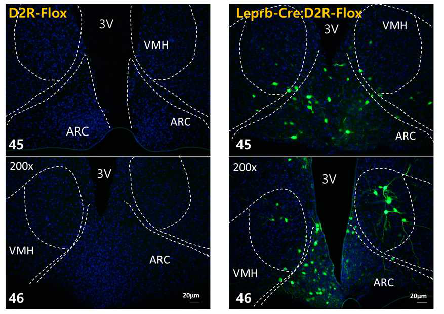 D2R flox와 D2R flox;LepRb-Cre 쥐에서 AAV-DIO-eYFP virus 이용하여 Cre의 발현 관찰. D2R flox(WT) 쥐와 D2R flox;LepRb-Cre(KO) 쥐의 궁상핵(arcuate nucleus, ARC)과 복내측 시상하부(ventromedial hypothalamus, VMH)에 AAV-DIO-eYFP (2.61x10^11VP/ml) virus를 각각 미량 주사함. 2주간의 회복기간을 거친 후 쥐의 뇌를 관류(perfusion)를 이용하여 4% PFA(paraformaldehyde) 로 고정 후 적출하여 40μm로 동결박편하고 세포의 핵을 counterstain 후 mounting 하여 형광 신호를 관찰