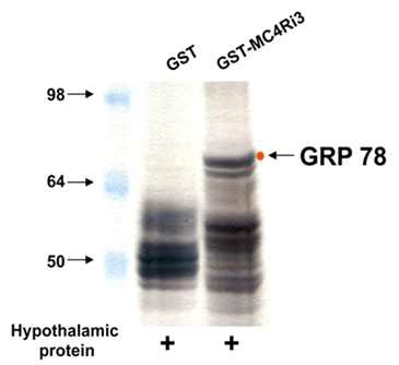 MC4R 의 세포 내 세 번째 고리와 마우스의 시상하부 단백질간의 GST pull-down assay 결과