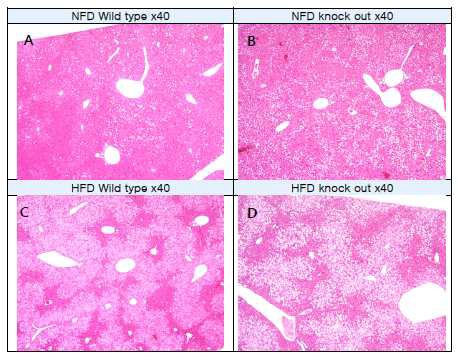 Liver 조직 H&E 염색 결과