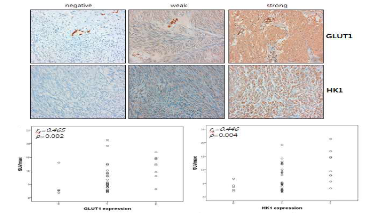 소화기 간질 종양에서 GLUT1, HK1의 IHC 결과 및 18FDG와의 상관관계 그래프