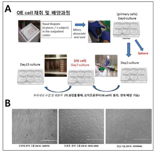 인간 유래 ONE 세포주 배양기법 도입. (A) 인간 유래 ONE cell 채취 위한 생검 및 배양 과정 모식도. (B) 조현병, 조울증, 정상 그룹의 배양 7일 째의 ONE cells. (scale bar:1mm)