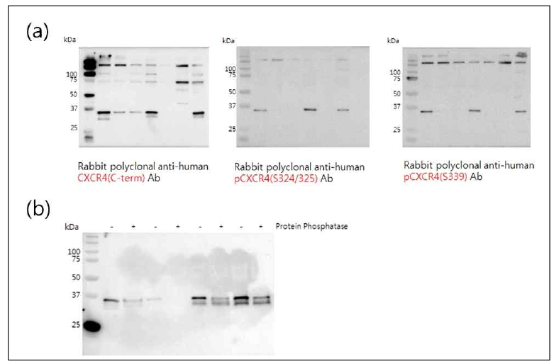 (a) Glioma cell의 Extracellular vesicle에서 CXCR4의 확인 (b) Protein phosphatase 처리 후 CXCR4의 확인