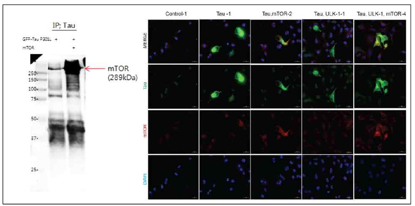 mTOR와 Tau의 상호간의 연관성 확인