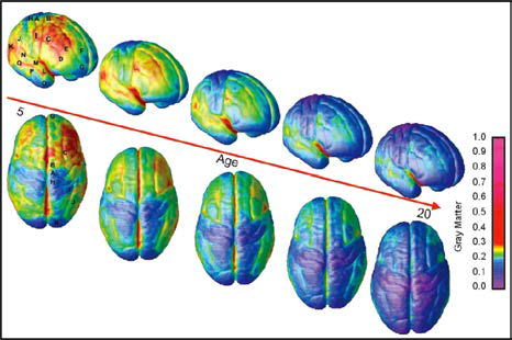 5세~20세 사이의 생애주기별 회백질 두께의 변화 추이