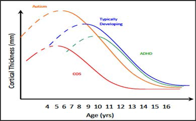 신경발달질환들에서의 연령 별 뇌 피질 두께의 변화 추이 모델[6]. (COS: child-onsetschizophrenia, 아동기 발병 조현병, Autism: 자폐증, ADHD: 주의력결핍과잉 행동장애)