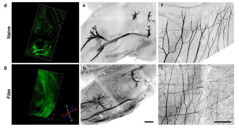 조직필름화 전후 E13.5 HB9-GFP 말초신경 이미징