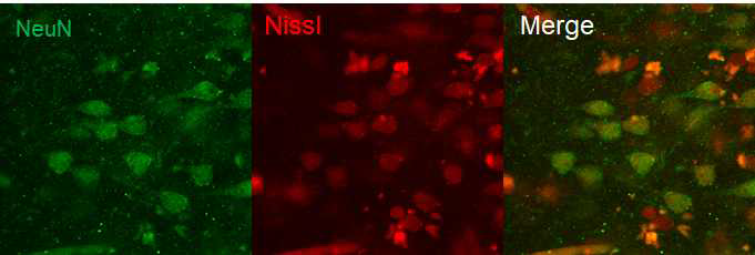 인간뇌조직에서 Nissl과 NeuN 동시염색