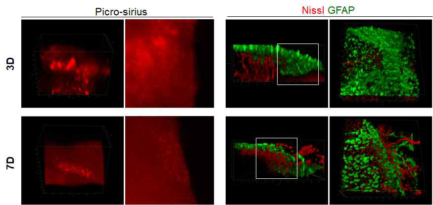 TBI 모델에서 Nissl 및 Picro-sirius Red 염색