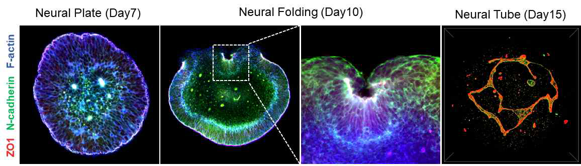 인간만능줄기세포 유래 오가노이드를 이용한 신경관 형성과정 관찰