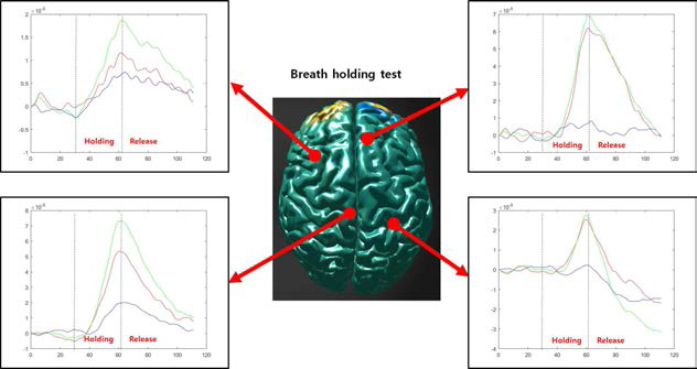 Breath holding test를 수행하였을 시의 뇌의 전역에서 혈류 산소포화도 농도 변화