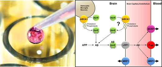 혈중 알츠하이머 특이적 단백질 분석